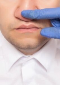 Tabique nasal desviado y obstruido - Septoplastia Dr. Jorge Duque Silva